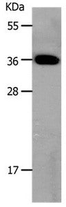 Gel: 10%SDS-PAGE Lysates (from left to right): Mouse large intestine tissue Amount of lysate: 30ug per lane Primary antibody: 1/800 dilution Secondary antibody dilution: 1/8000 Exposure time: 20 seconds