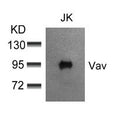 Western blot analysis of extracts from JK cells using Vav(Ab-174) Antibody.