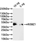Western Blot
Positive WB detected in: recombinant protein
All lanes:RISBZ1 Antibody at 1:1000
Secondary
Goat polyclonal to rabbit IgG at 1/20000 dilution
Predicted band size: 28.9 kDa
Observed band size: 39 kDa