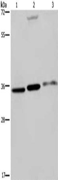 Gel: 8%SDS-PAGE, Lysate: 40 ug, Lane 1-3: A375 cells, 293T cells, SKOV3 cells, Primary antibody: CSB-PA264237(PITX2 Antibody) at dilution 1/250, Secondary antibody: Goat anti rabbit IgG at 1/8000 dilution, Exposure time: 20 seconds