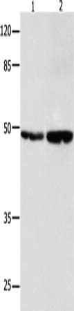Gel: 10%SDS-PAGE, Lysate: 40 ug, Lane 1-2: 231 cells, OP9 cells, Primary antibody: CSB-PA264573(SPP1 Antibody) at dilution 1/350, Secondary antibody: Goat anti rabbit IgG at 1/8000 dilution, Exposure time: 2 minutes