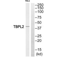Western blot analysis of extracts from HeLa cells, using TBPL2 antibody.