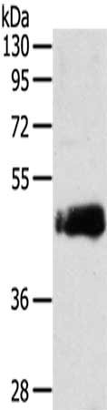 Gel: 8%SDS-PAGE,Lysate: 40 ug,,Primary antibody: CSB-PA265061(SDCCAG3 Antibody) at dilution 1/235 dilution,Secondary antibody: Goat anti rabbit IgG at 1/8000 dilution,Exposure time: 2 minutes