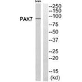 Western blot analysis of extracts from rat brain cells, using PAK7 antibody.