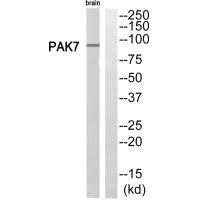 Western blot analysis of extracts from rat brain cells, using PAK7 antibody.