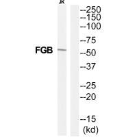 Western blot analysis of extracts from Jurkat cells, using FIBB antibody.