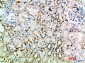 Immunohistochemical analysis of paraffin-embedded human-kidney, antibody was diluted at 1:200