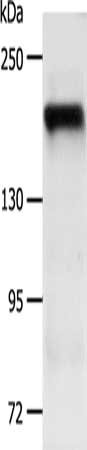 Gel: 8%SDS-PAGE, Lysate: 40 ug, Lane: NIH/3T3 cells, Primary antibody: CSB-PA266610(PDGFRB Antibody) at dilution 1/200, Secondary antibody: Goat anti rabbit IgG at 1/8000 dilution, Exposure time: 1 minute