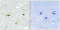 Immunohistochemical analysis of paraffin-embedded human brain tissue using STK39 (Phospho-Ser323) antibody (left)or the same antibody preincubated with blocking peptide (right).