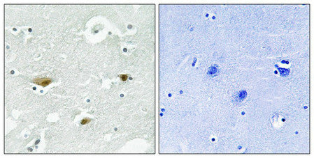 Immunohistochemical analysis of paraffin-embedded human brain tissue using STK39 (Phospho-Ser323) antibody (left)or the same antibody preincubated with blocking peptide (right).