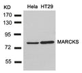 Western blot analysis of extracts from Hela and HT29 cells using MARCKS(Ab-162) Antibody.