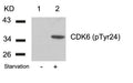 Western blot analysis of extracts from 293 cells untreated(lane 1) or treated with starvation(lane 2) using CDK6(phospho-Tyr24) Antibody.