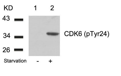 Western blot analysis of extracts from 293 cells untreated(lane 1) or treated with starvation(lane 2) using CDK6(phospho-Tyr24) Antibody.