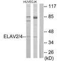 Western blot analysis of extracts from HUVEC cells and Jurkat cells, using ELAV2/4 antibody.