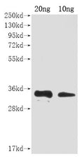 Western Blot
Positive WB detected in Recombinant protein
All lanes: A27L antibody at 1:2000
Secondary
Goat polyclonal to rabbit IgG at 1/50000 dilution
Predicted band size: 31 kDa
Observed band size: 31 kDa