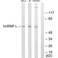 Western blot analysis of extracts from HeLa cells, Jurkat cells and HUVEC cells, using hnRNP L antibody.