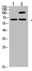 Western Blot analysis of 1,Hela 2,Mouse-kidney cells using primary antibody diluted at 1:2000(4°C overnight). Secondary antibody:Goat Anti-rabbit IgG IRDye 800( diluted at 1:5000, 25°C, 1 hour)
