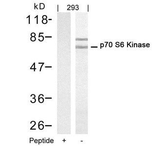 Western blot analysis of extracts from 293 cells using p70 S6 Kinase(Ab-421) Antibody(Lane 2) and the same antibody preincubated with blocking peptide(Lane1).