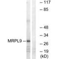 Western blot analysis of extracts from COLO cells, using MRPL9 antibody.