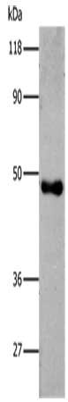 Gel: 8%SDS-PAGE, Lysate: 0.5 ug, Lane: Recombinant 6HIS Tagged protein , Primary antibody: CSB-PA270215(6His Antibody) at dilution 1/2000 (lane 1),1/5000 (lane 2),1/8000 (lane 3),1/10000 (lane 4), Secondary antibody: Goat anti rabbit IgG at 1/8000 dilution, Exposure time: 5 seconds