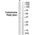 Western blot analysis of extracts from Jurkat cells, using Cytochrome P450 20A1 antibody.
