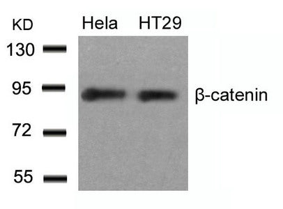 Western blot analysis of extracts from Hela and HT29 cells using b-Catenin(Ab-33) Antibody.