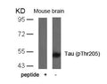 Western blot analysis of extracts from mouse brain tissue using Tau(Phospho-Thr205) Antibody and the same antibody preincubated with blocking peptide.