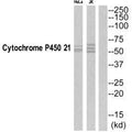 Western blot analysis of extracts from Jurkat/HeLa cells, using CYP21A2 antibody.