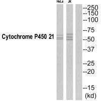 Western blot analysis of extracts from Jurkat/HeLa cells, using CYP21A2 antibody.