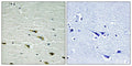 Immunohistochemical analysis of paraffin-embedded human brain tissue using Trk A (Phospho-Tyr757) antibody (left)or the same antibody preincubated with blocking peptide (right).