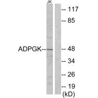 Western blot analysis of extracts from Jurkat cells, using ADPGK antibody.