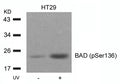Western blot analysis of extracts from HT29 cells untreated or treated with UV using BAD(Phospho-Ser136) Antibody.