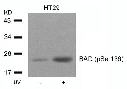 Western blot analysis of extracts from HT29 cells untreated or treated with UV using BAD(Phospho-Ser136) Antibody.