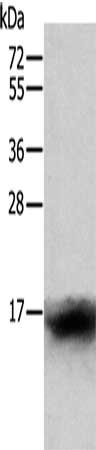 Gel: 12%SDS-PAGE, Lysate: 40 ug, Lane: Human lymphoma tissue, Primary antibody: CSB-PA272302(CCL24 Antibody) at dilution 1/400, Secondary antibody: Goat anti rabbit IgG at 1/8000 dilution, Exposure time: 1 minute
