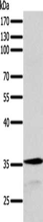 Gel: 10%SDS-PAGE, Lysate: 40 ug, Lane: MCF7 cells, Primary antibody: CSB-PA272409(SYT9 Antibody) at dilution 1/200, Secondary antibody: Goat anti rabbit IgG at 1/8000 dilution, Exposure time: 1 minute