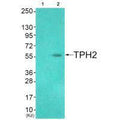 Western blot analysis of extracts from HuvEc cells (Lane 2), using TPH2 (Ab-19) antiobdy. The lane on the left is treated with systhesized peptide.