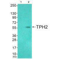 Western blot analysis of extracts from HuvEc cells (Lane 2), using TPH2 (Ab-19) antiobdy. The lane on the left is treated with systhesized peptide.