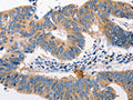 MTOR Antibody – Figure 1 of 2