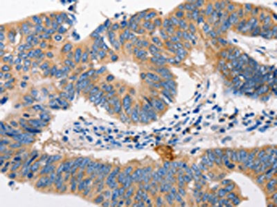MTOR Antibody – Figure 1 of 2
