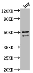 Western Blot
Positive WB detected in Recombinant protein
All lanes: DGAT3 antibody at 1:2000
Secondary
Goat polyclonal to rabbit IgG at 1/50000 dilution
Predicted band size: 43.2 kDa
Observed band size: 44 kDa