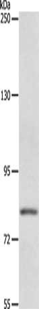 Gel: 8%SDS-PAGE, Lysate: 40 ug, Lane: Mouse liver tissue, Primary antibody: CSB-PA273896(ABCB6 Antibody) at dilution 1/250, Secondary antibody: Goat anti rabbit IgG at 1/8000 dilution, Exposure time: 2 minutes