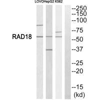 Western blot analysis of extracts from LOVO cells, HepG2 cells and K562 cells, using RAD18 antibody.