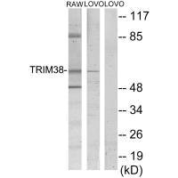 Western blot analysis of extracts from RAW264.7 cells and LOVO cells, using TRIM38 antibody.