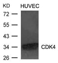 Western blot analysis of extracts from HUVEC cells using CDK4 Antibody.