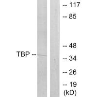 Western blot analysis of extracts from 293 cells, using TBP antibody.