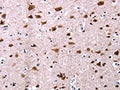 CSNK2A1 Antibody – Figure 1 of 3