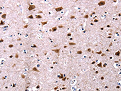 CSNK2A1 Antibody – Figure 1 of 3