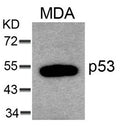 Western blot analysis of extracts from MDA cells using p53(Ab-6) Antibody.