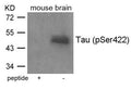 Western blot analysis of extracts from mouse brain tissue using Tau(Phospho-Ser422) Antibody and the same antibody preincubated with blocking peptide.