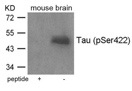 Western blot analysis of extracts from mouse brain tissue using Tau(Phospho-Ser422) Antibody and the same antibody preincubated with blocking peptide.